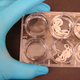 Image for article titled Sounds Gross, But Intestinal Worms Can Actually Be Good For You